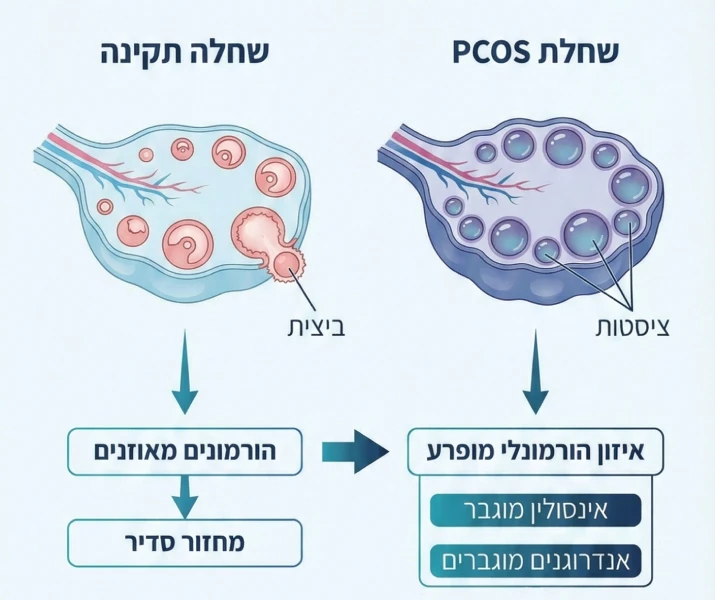 pcos_2